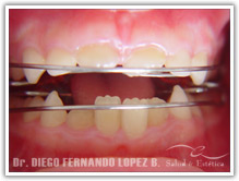 tecnicas-ortopedia-maxilar.jpg